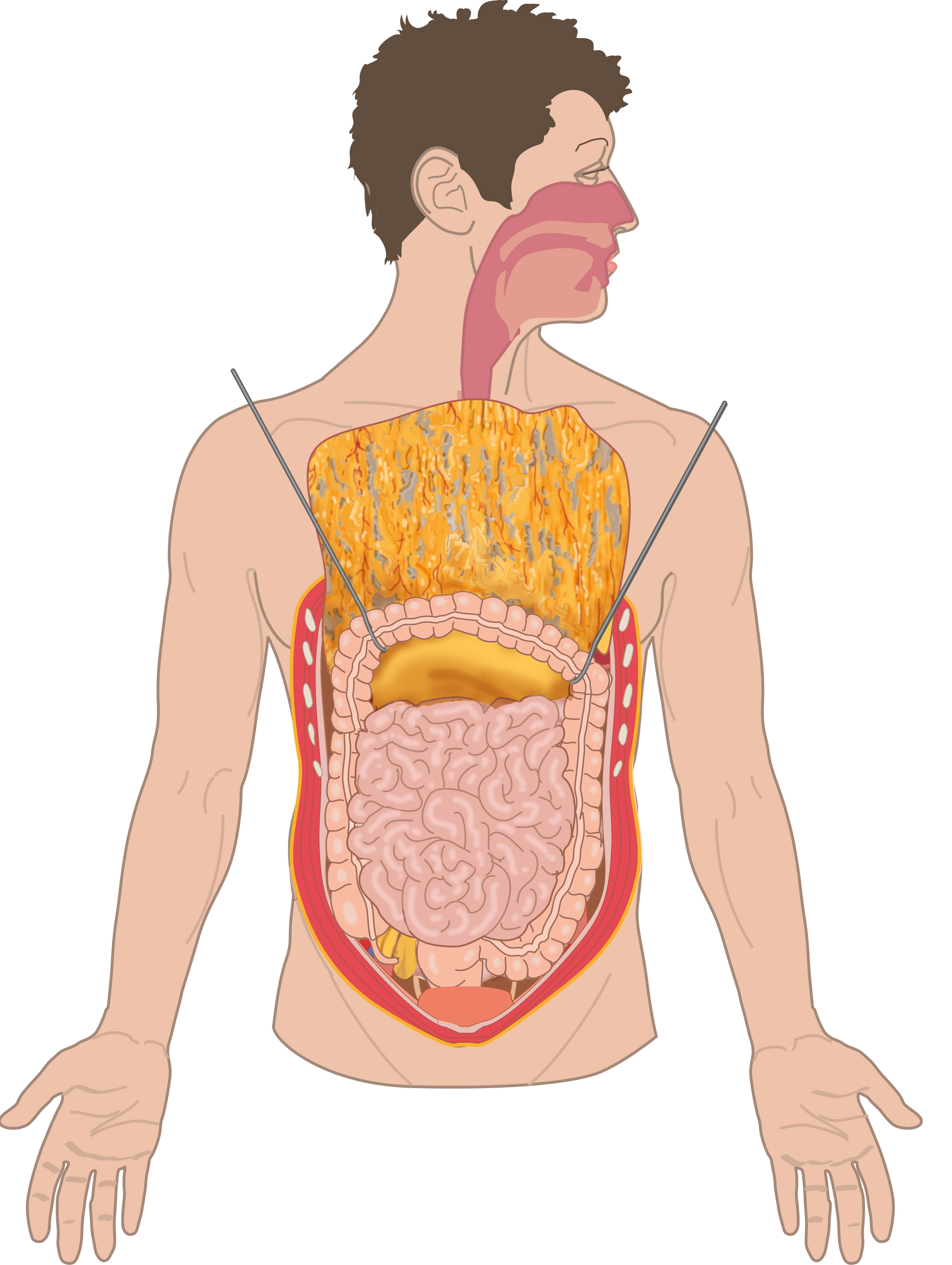 slagter-drawing-opened-abdomen-greater-omentum-lifted-no-labels